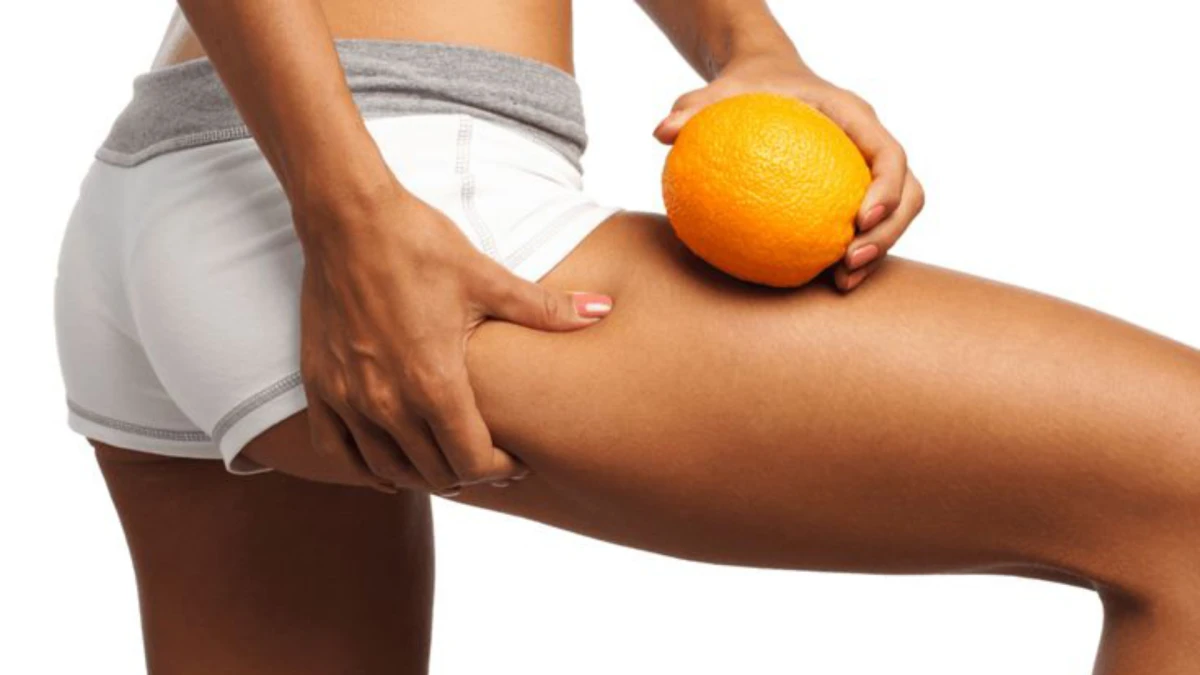 橘皮組織是什麼？筋肉媽媽：唯有「這招」能徹底消除它
