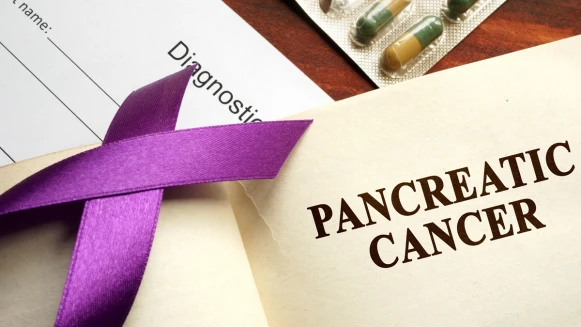 胰臟癌奪命快又狠！醫揭6大高危族群 防癌指南全解析