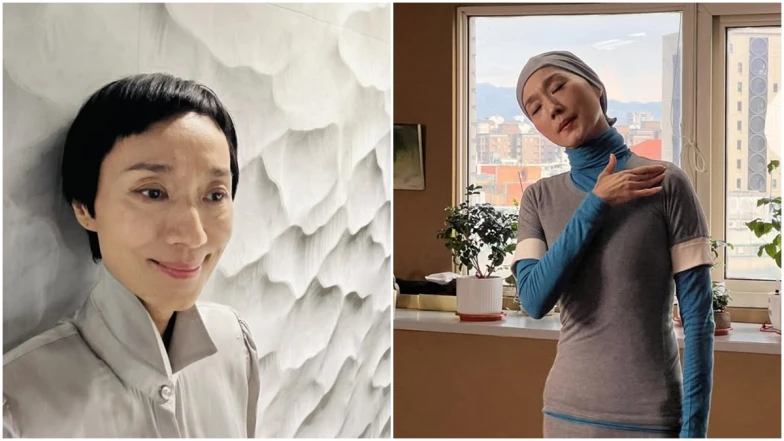 坣娜驚傳紅斑性狼瘡病逝？紅斑性狼瘡症狀是什麼？為何會死亡？可痊癒嗎？醫詳解迷思